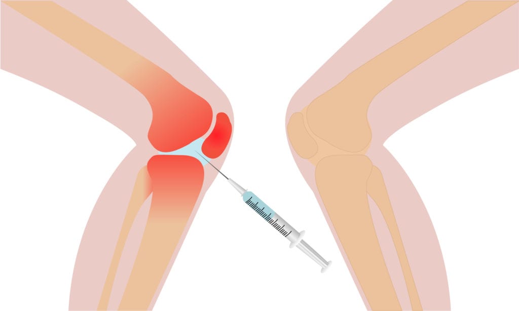 Cold Joint Injection Services | Landry Osteopathic Healthcare, PA LLC.